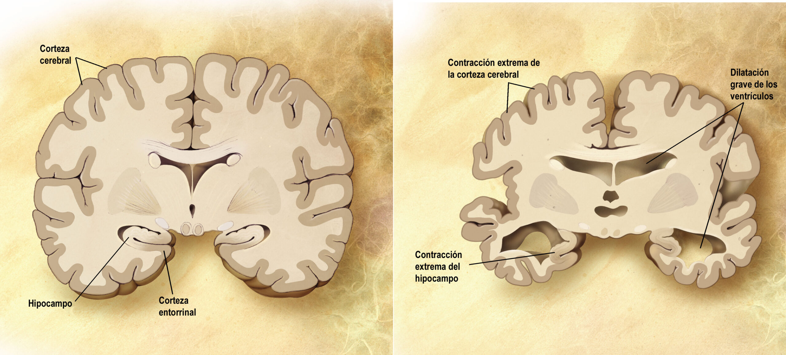 Alzheimer Bakımı: Aileler İçin Psikolojik Destek Yöntemleri