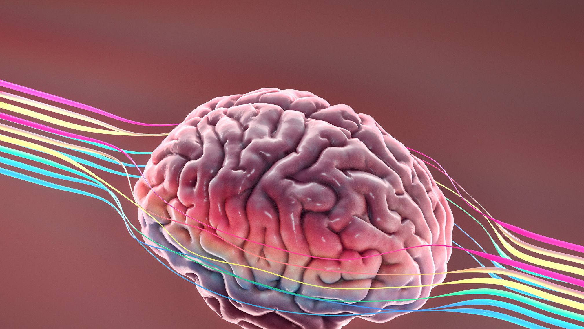 Alzheimer