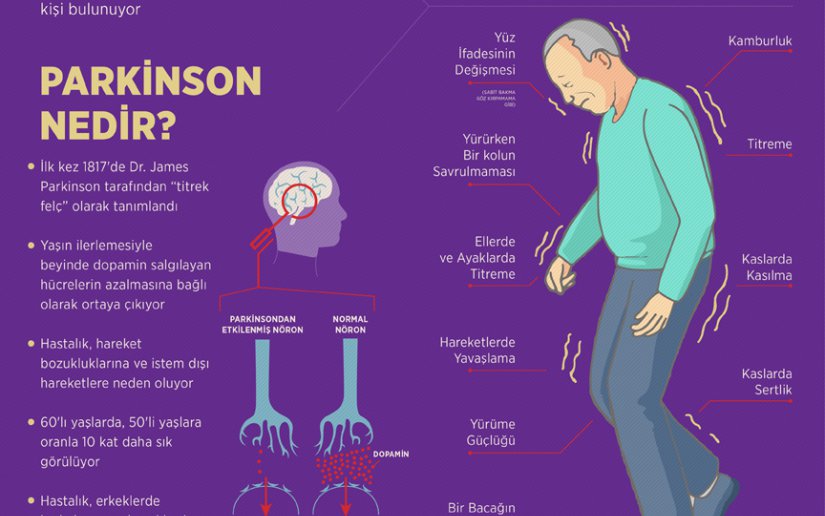 Parkinson Hastalığı Parkinson Hastalığı